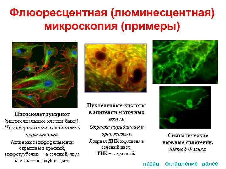 Флюоресцентная (люминесцентная) микроскопия (примеры) . . Цитоскелет эукариот (эндотелиальные клетки быка). Имунноцитохимический метод окрашивания.