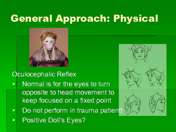 General Approach: Physical Oculocephalic Reflex § Normal is for the eyes to turn opposite