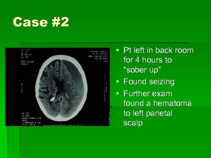 Case #2 § Pt left in back room for 4 hours to “sober up”