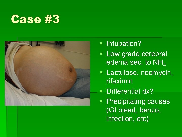 Case #3 § Intubation? § Low grade cerebral edema sec. to NH 4 §