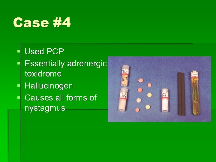 Case #4 § Used PCP § Essentially adrenergic toxidrome § Hallucinogen § Causes all
