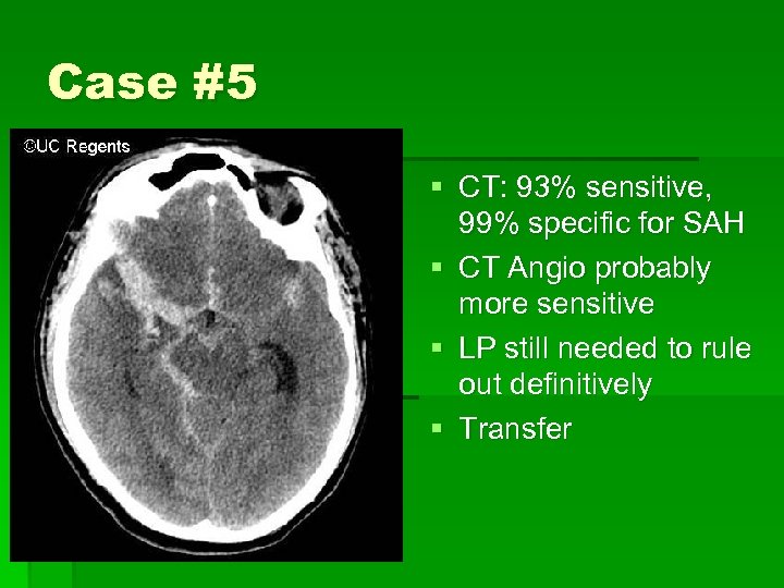 Case #5 § CT: 93% sensitive, 99% specific for SAH § CT Angio probably