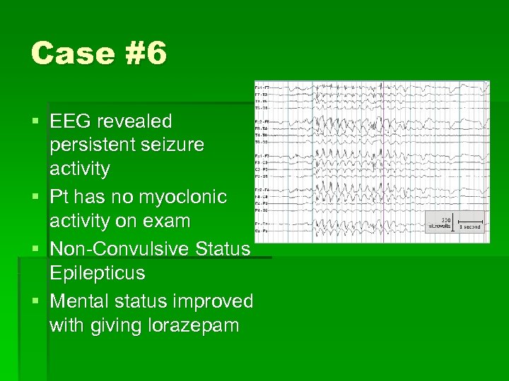 Case #6 § EEG revealed persistent seizure activity § Pt has no myoclonic activity
