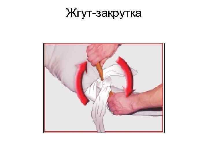 Жгут-закрутка 