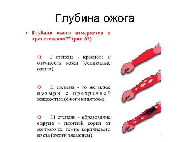 Глубина ожога 