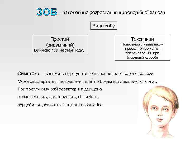 – патологічне розростання щитоподібної залози Види зобу Простий (эндемічний) Виникає при нестачі іоду, Токсичний