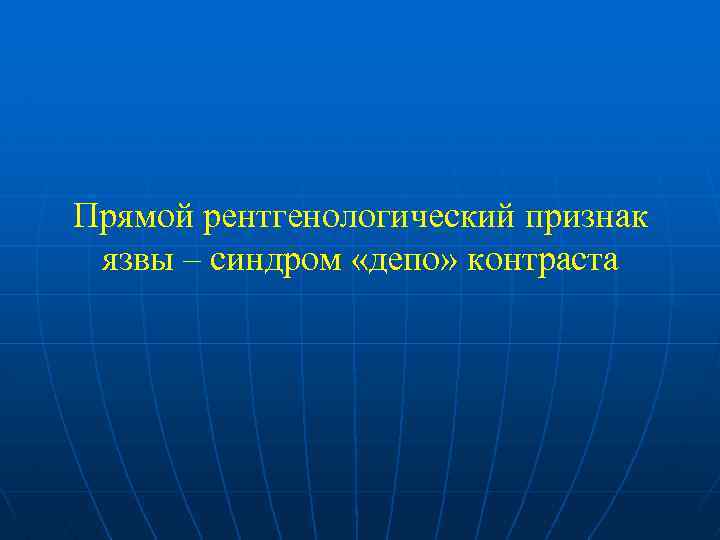 Прямой рентгенологический признак язвы – синдром «депо» контраста 