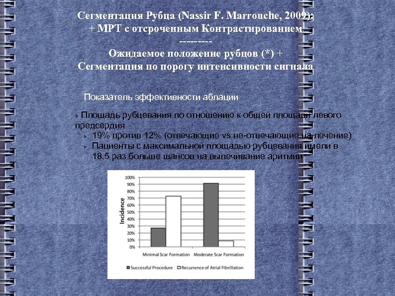 Сегментация Рубца (Nassir F. Marrouche, 2009): + МРТ с отсроченным Контрастированием ----Ожидаемое положение рубцов