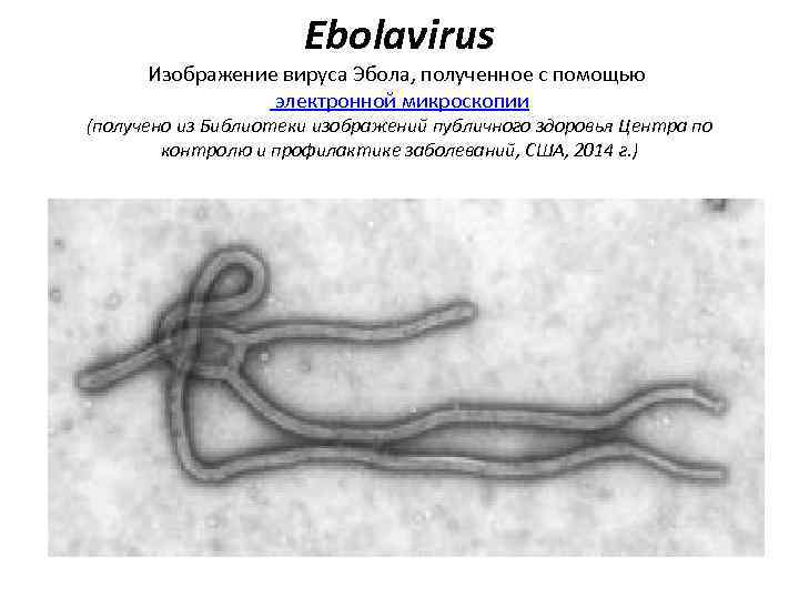 Ebolavirus Изображение вируса Эбола, полученное с помощью электронной микроскопии (получено из Библиотеки изображений публичного