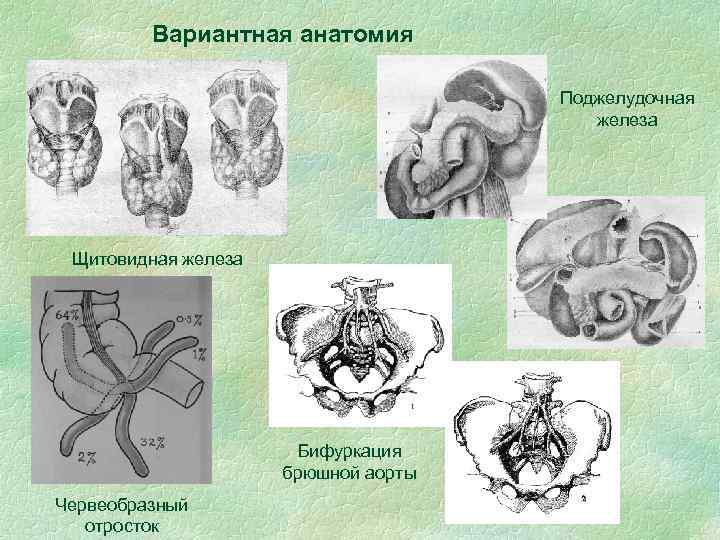 Вариантная анатомия Поджелудочная железа Щитовидная железа Бифуркация брюшной аорты Червеобразный отросток 