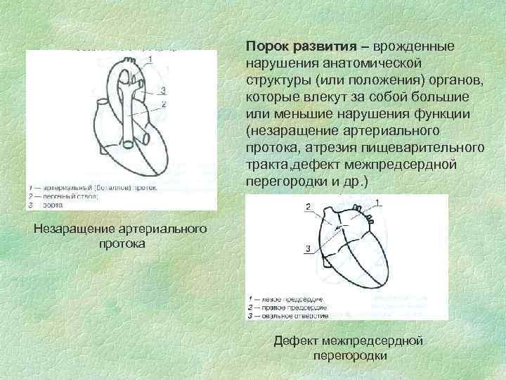 Порок развития – врожденные нарушения анатомической структуры (или положения) органов, которые влекут за собой