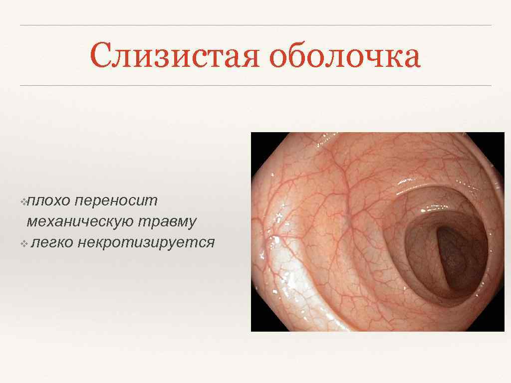 Слизистая оболочка ❖плохо переносит механическую травму ❖ легко некротизируется 