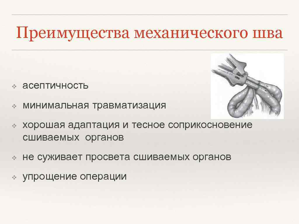 Преимущества механического шва ❖ асептичность ❖ минимальная травматизация ❖ хорошая адаптация и тесное соприкосновение