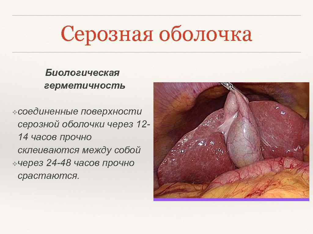 Серозная оболочка Биологическая герметичность ❖соединенные поверхности серозной оболочки через 1214 часов прочно склеиваются между