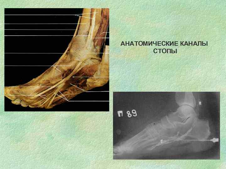 АНАТОМИЧЕСКИЕ КАНАЛЫ СТОПЫ 