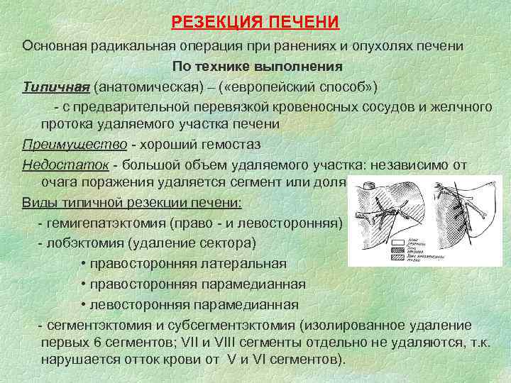 РЕЗЕКЦИЯ ПЕЧЕНИ Основная радикальная операция при ранениях и опухолях печени По технике выполнения Типичная