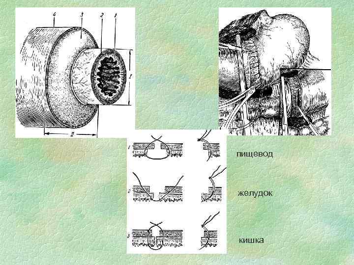пищевод желудок кишка 