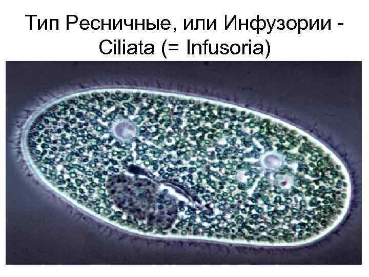 Тип Ресничные, или Инфузории Ciliata (= Infusoria) 