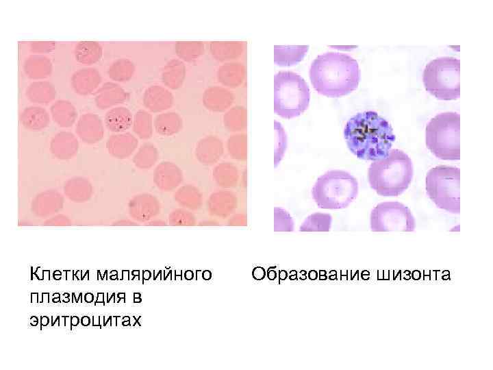 Клетки малярийного плазмодия в эритроцитах Образование шизонта 