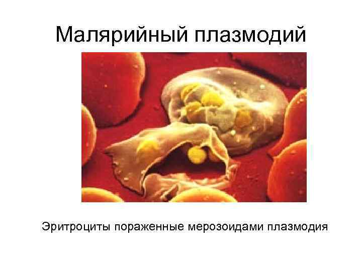 Малярийный плазмодий Эритроциты пораженные мерозоидами плазмодия 