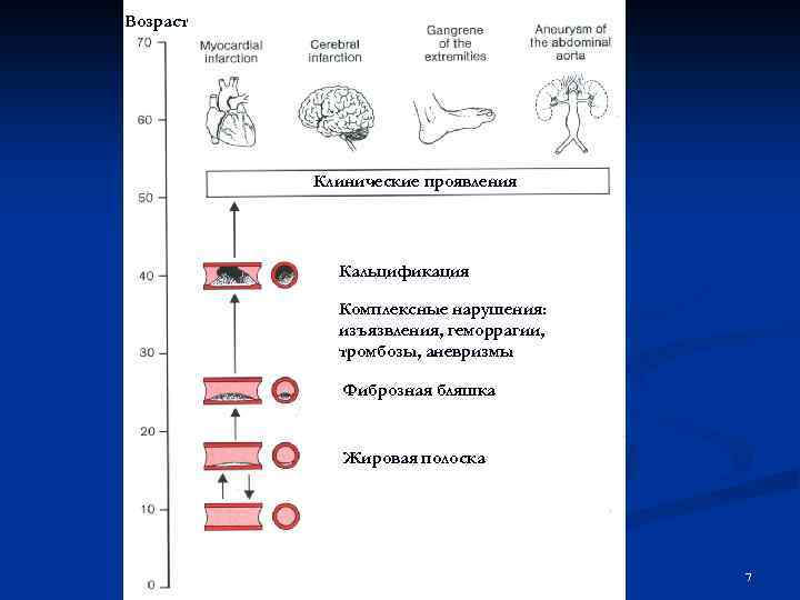 Возраст Клинические проявления Кальцификация Комплексные нарушения: изъязвления, геморрагии, тромбозы, аневризмы Фиброзная бляшка Жировая полоска