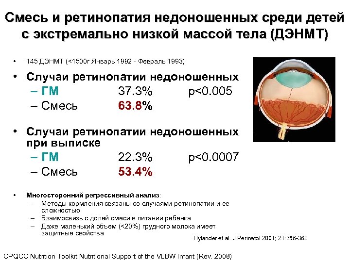 Какой вес недоношенного ребенка. Экстремально низкая масса тела. Недоношенный с экстремально низкой массой тела. Факторы риска ретинопатии недоношенных.