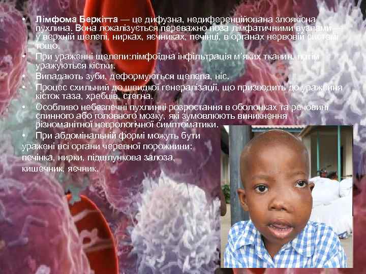  • Лімфома Беркітта — це дифузна, недиференційована злоякісна пухлина. Вона локалізується переважно поза