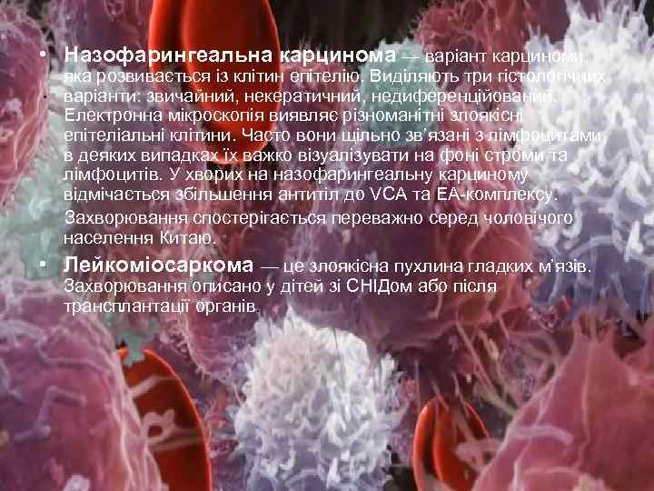  • Назофарингеальна карцинома — варіант карциноми, яка розвивається із клітин епітелію. Виділяють три