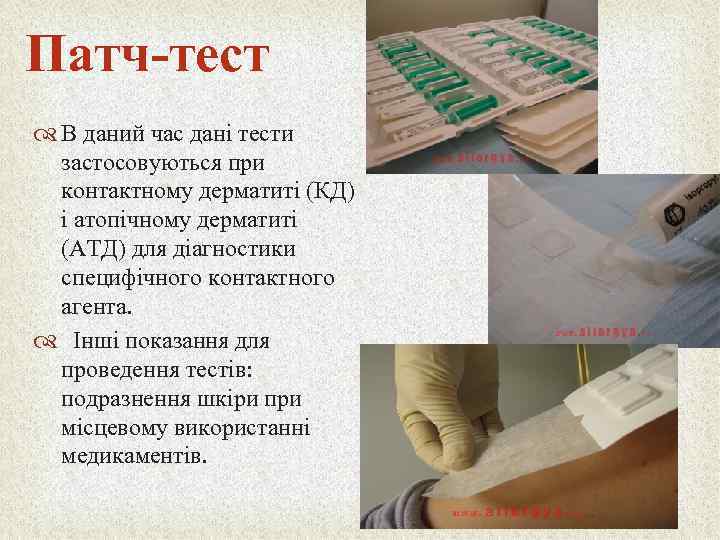 Патч-тест В даний час дані тести застосовуються при контактному дерматиті (КД) і атопічному дерматиті