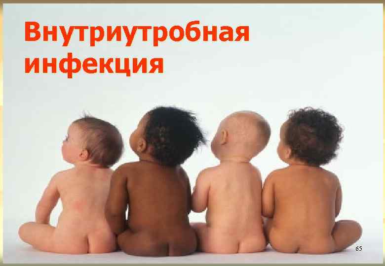 Внутриутробная инфекция 65 