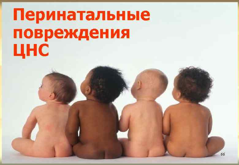 Перинатальные повреждения ЦНС 66 