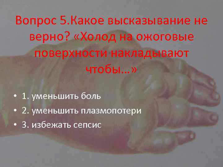 Вопрос 5. Какое высказывание не верно? «Холод на ожоговые поверхности накладывают чтобы…» • 1.