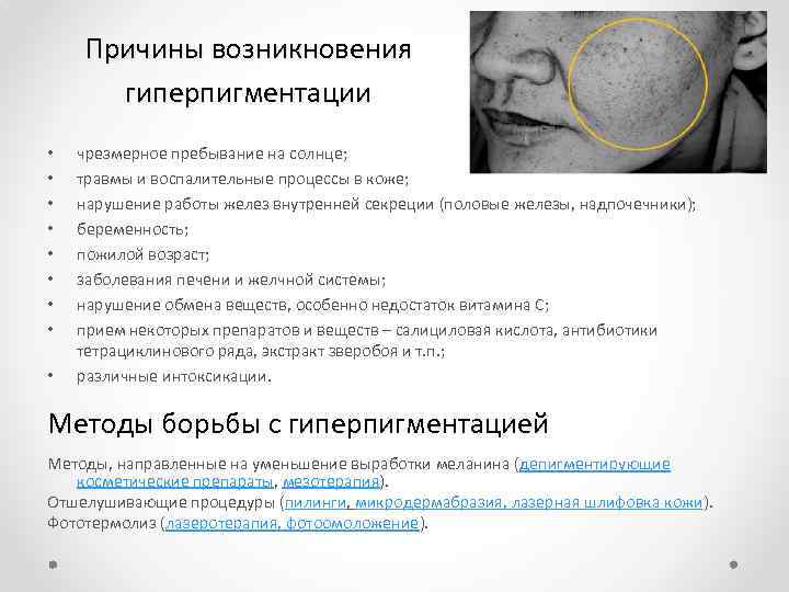 Причины возникновения гиперпигментации • • • чрезмерное пребывание на солнце; травмы и воспалительные процессы