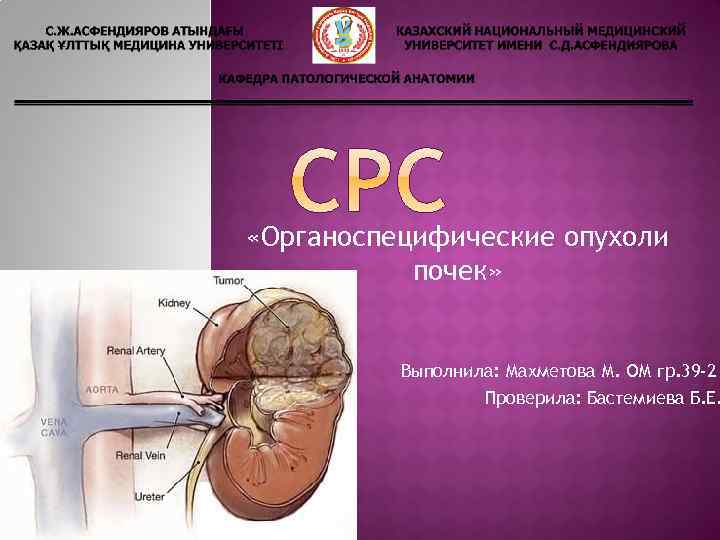  «Органоспецифические опухоли почек» Выполнила: Махметова М. ОМ гр. 39 -2 Проверила: Бастемиева Б.