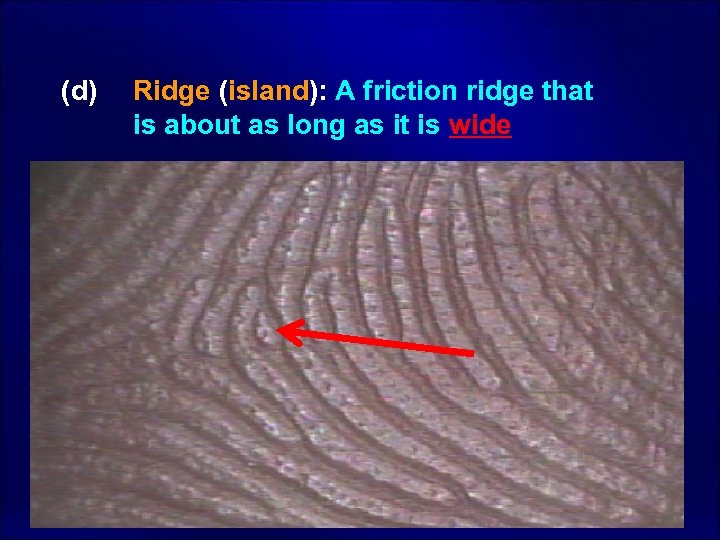 (d) Ridge (island): A friction ridge that is about as long as it is