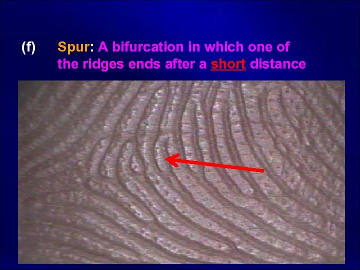 (f) Spur: A bifurcation in which one of the ridges ends after a short