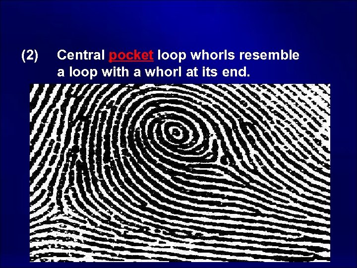 (2) Central pocket loop whorls resemble a loop with a whorl at its end.