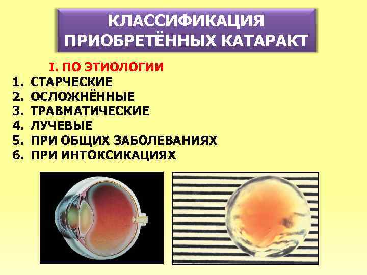 Лучевая диагностика в оториноларингологии и офтальмологии презентация