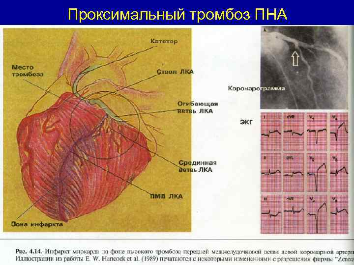 Проксимальный это