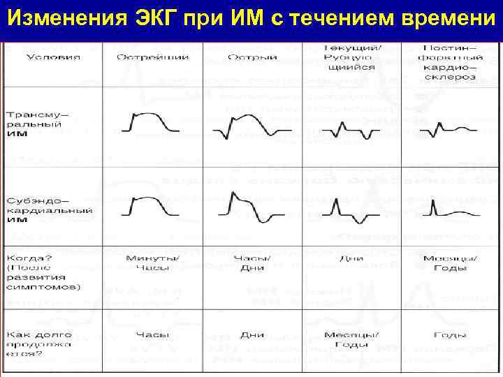 Изменения ЭКГ при ИМ с течением времени 