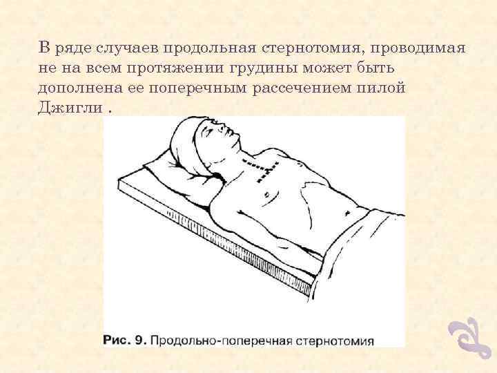 В ряде случаев продольная стернотомия, проводимая не на всем протяжении грудины может быть дополнена