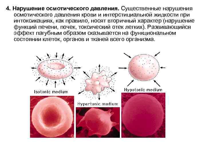 4. Нарушение осмотического давления. Существенные нарушения осмотического давления крови и интерстициальной жидкости при интоксикациях,