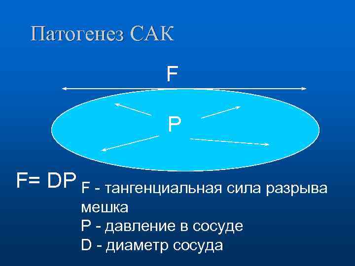 Патогенез САК F Р F= DP F - тангенциальная сила разрыва мешка Р -