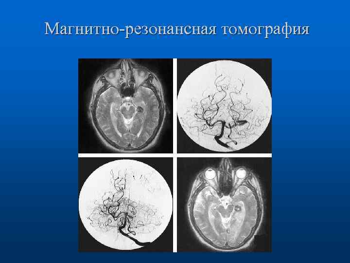 Магнитно-резонансная томография 