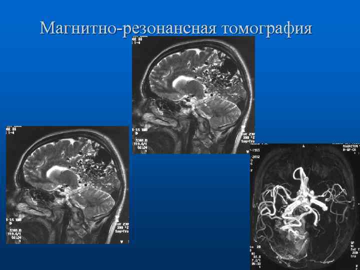Магнитно-резонансная томография 