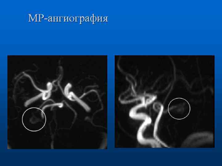 МР-ангиография 