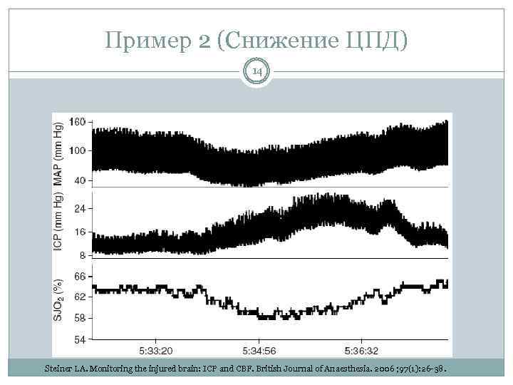 Пример 2 (Снижение ЦПД) 14 Steiner LA. Monitoring the injured brain: ICP and CBF.