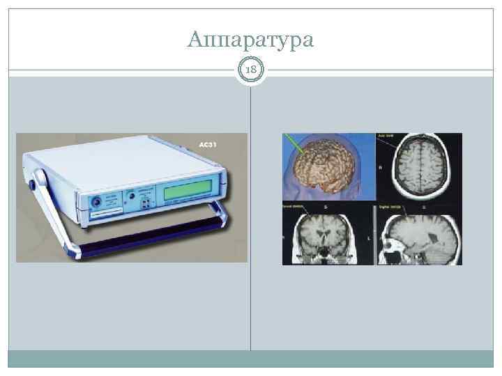 Аппаратура 18 