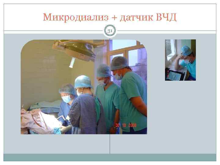 Микродиализ + датчик ВЧД 31 