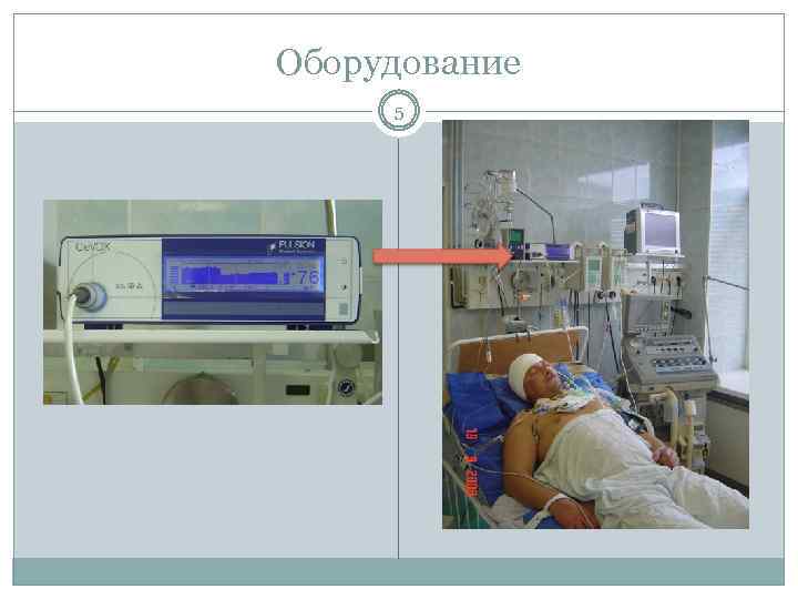 Оборудование 5 